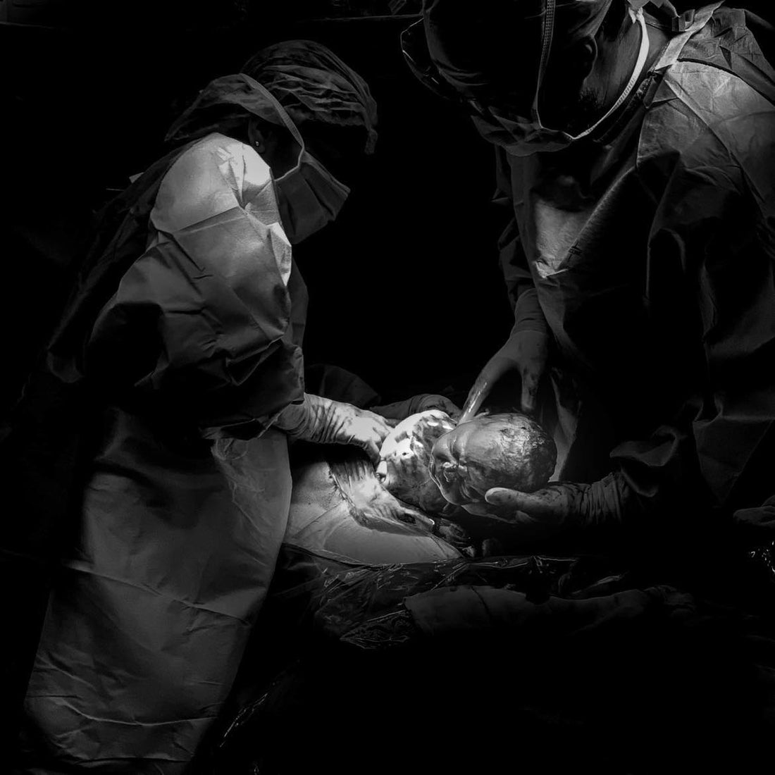 APRIL is Caesarean Awareness Month: I'm sharing my story. - Rumi and Sol